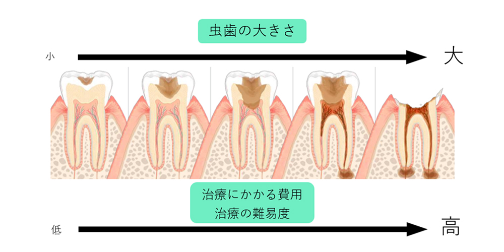 早期に良質な治療を受けた方が、その後の治療費を抑えることができます。